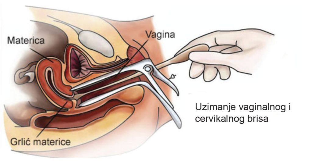 genitalni bris