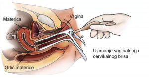 genitalnih briseva