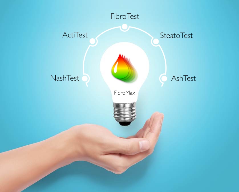 Fibro Test i Fibro Max Test - neinvanzivna alternativa za biopsiju jetre 1