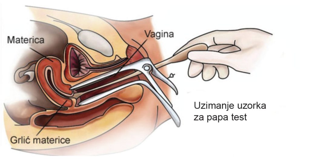 Priprema kod uzimanja uzoraka za Papa test 1