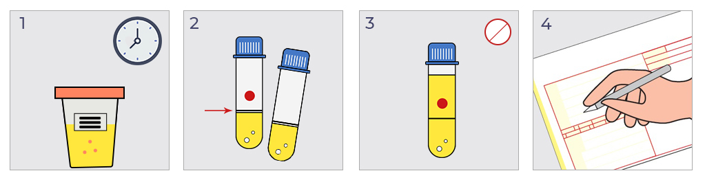 Uputstvo za sakupljanje urina za peptiduriju2