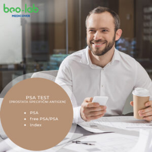 PSA test (prostata specifični antigen) – profil