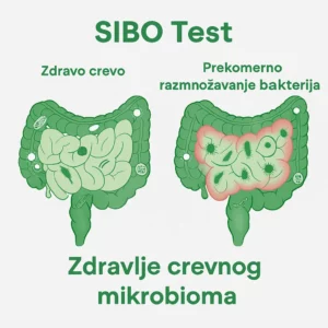 SIBO test (Sindrom kontaminiranog creva izdisajni test)