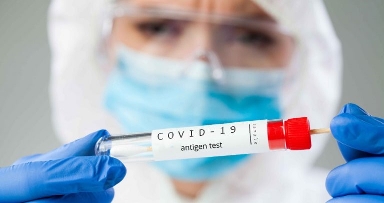 Antigen test na COVID-19