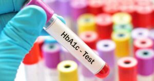 Analiza HbA1c Beo-lab