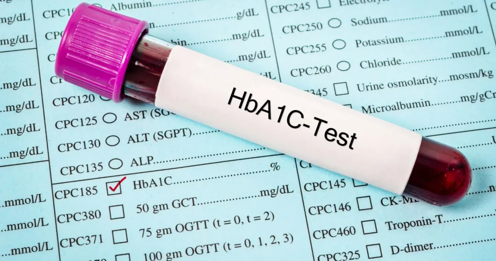 HBA1C test