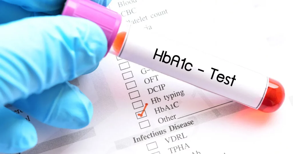 HBA1C referentne vrednosti