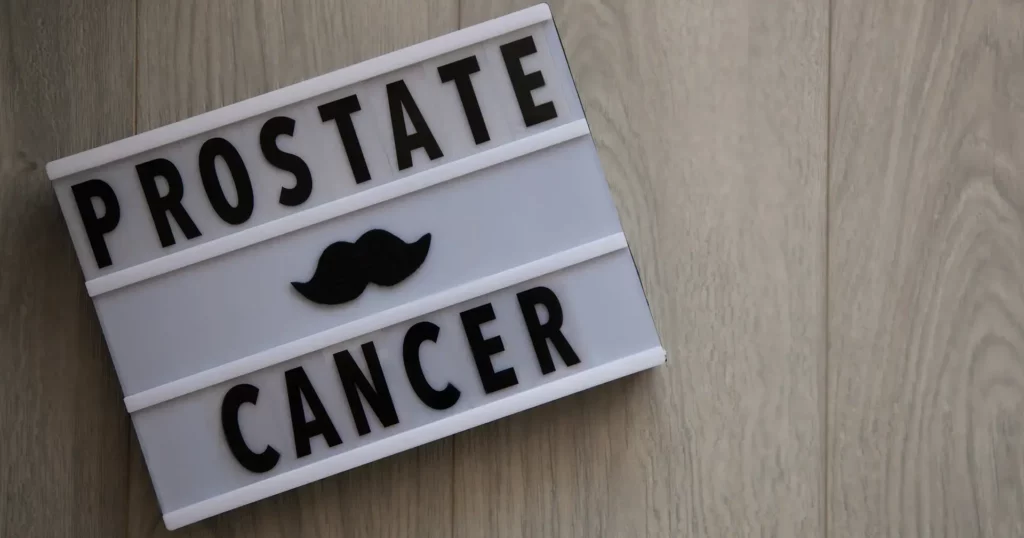 Oboljenja prostate-simptomi, dijagnoza i laboratorijski testovi 3