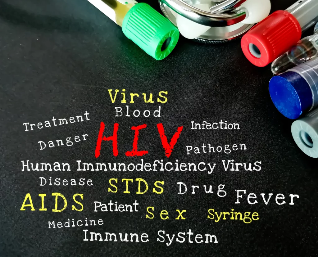 HIV/AIDS – uzroci, simptomi, dijagnoza 1