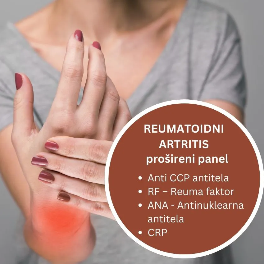 Reumatoidni artritis vizual