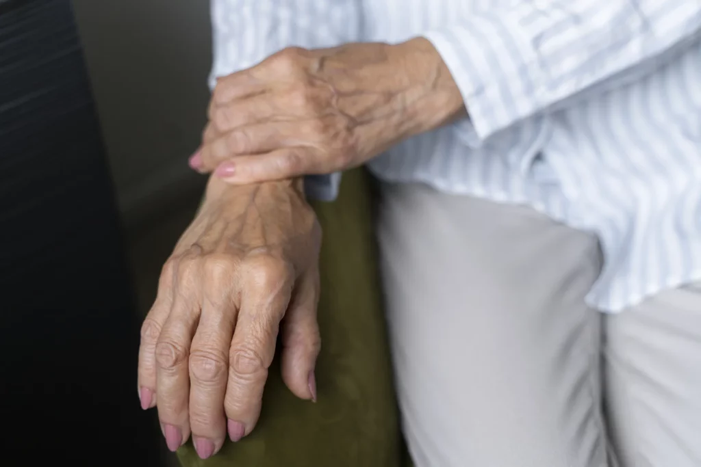 Reumatoidni artritis – simptomi, uzroci, dijagnostika i terapija 8
