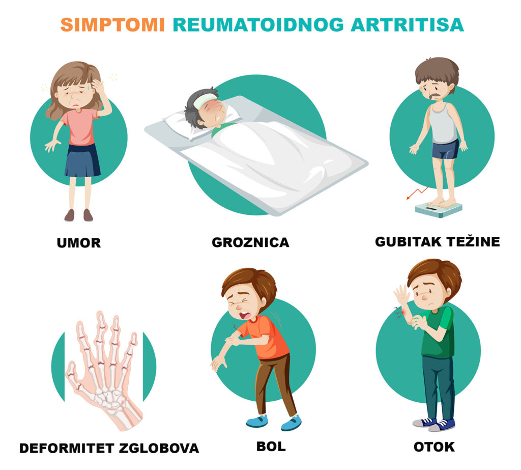 Reumatoidni artritis – simptomi, uzroci, dijagnostika i terapija 2