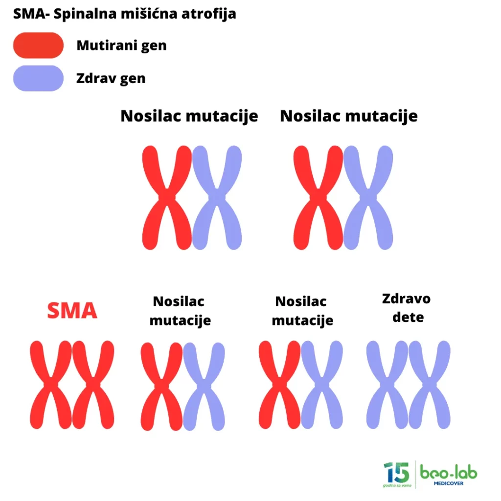 Spinalna mišićna atrofija-simptomi, uzrok nastanka, postavljanje dijagnoze i lečenje 20