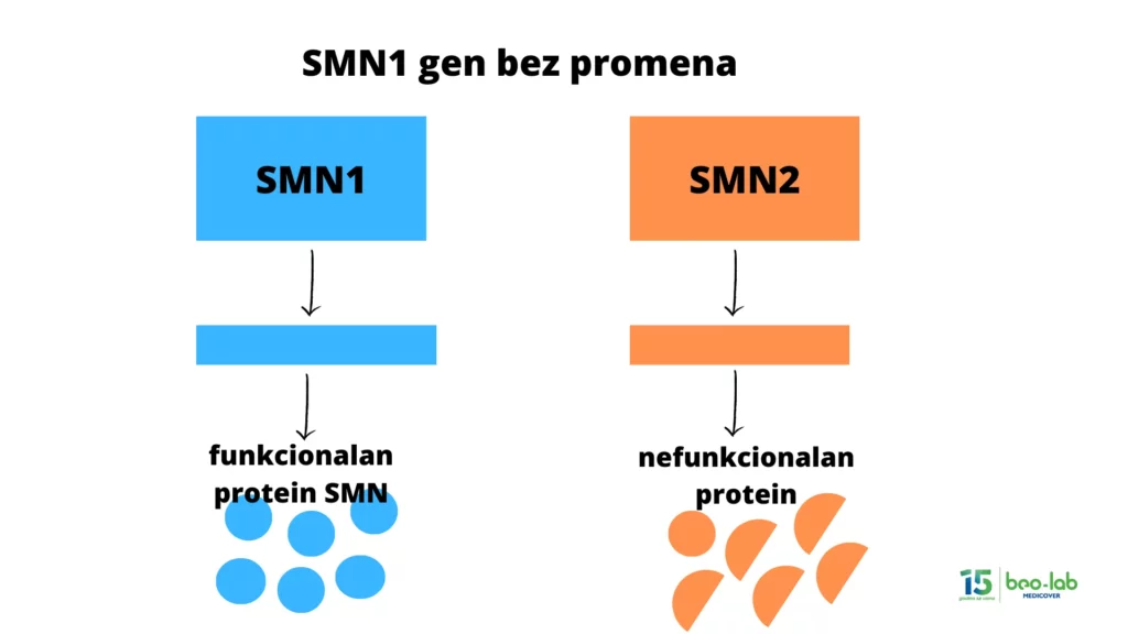 Spinalna mišićna atrofija-simptomi, uzrok nastanka, postavljanje dijagnoze i lečenje 5