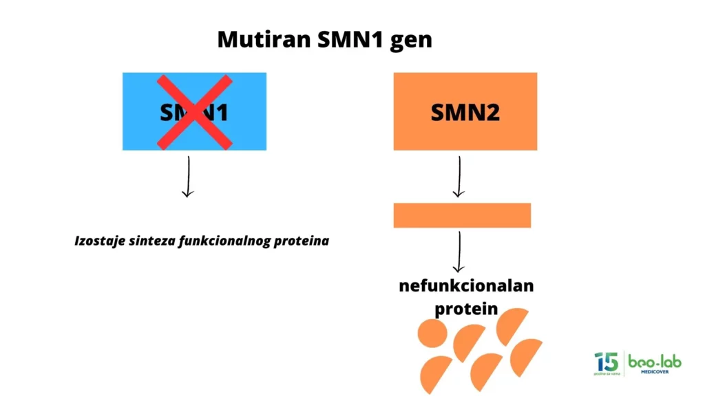 Spinalna mišićna atrofija-simptomi, uzrok nastanka, postavljanje dijagnoze i lečenje 27