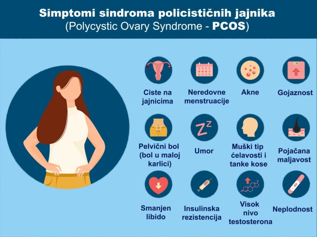 Sindrom policističnih jajnika (PCOS) simptomi, dijagnoza i terapija 2