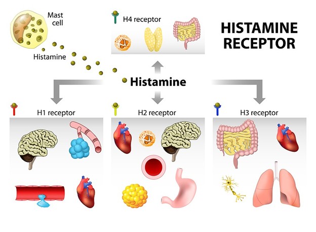 Intolerancija na histamin 1