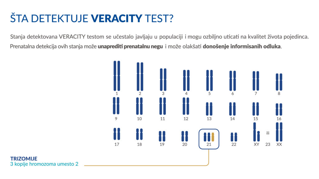 Šta detektuje Veracity test